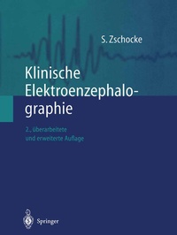 Abbildung von: Klinische Elektroenzephalographie - Springer