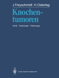 Abbildung von: Knochentumoren - Springer