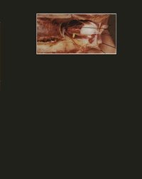 Abbildung von: Photographischer Atlas der Praktischen Anatomie II - Springer