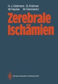 Abbildung von: Zerebrale Ischämien - Springer