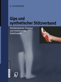 Abbildung von: Gips und synthetischer Stützverband - Steinkopff