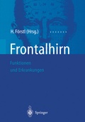 Abbildung von: Frontalhirn - Springer