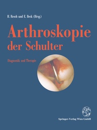 Abbildung von: Arthroskopie der Schulter - Springer