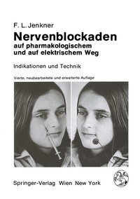 Abbildung von: Nervenblockaden auf pharmakologischem und auf elektrischem Weg - Springer