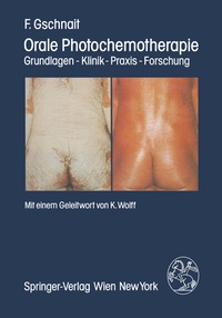 Abbildung von: Orale Photochemotherapie - Springer