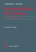 Cover: Hepatocellular Carcinoma - Springer