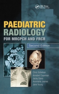Enlarge image Cover: Paediatric Radiology for MRCPCH and FRCR, Second Edition - CRC Press