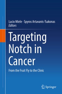 Abbildung von: Targeting Notch in Cancer - Springer
