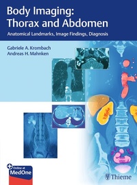 Abbildung von: Body Imaging: Thorax and Abdomen - Thieme