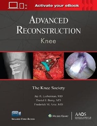 Enlarge image Cover: Advanced Reconstruction: Knee: Print + Ebook with Multimedia - WOLTERS KLUWER HEALTH