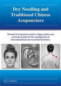 Abbildung von: Dry Needling and Traditional Chinese Acupuncture - Steve Bailey Acupuncture