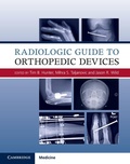 Cover: Radiologic Guide to Orthopedic Devices - Cambridge University Press