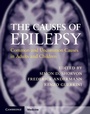Cover: Causes of Epilepsy - Cambridge University Press