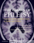 Cover: Causes of Epilepsy - Cambridge University Press