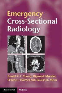 Enlarge image Cover: Emergency Cross-sectional Radiology - Cambridge University Press
