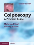 Cover: Colposcopy - Cambridge University Press
