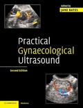 Cover: Practical Gynaecological Ultrasound - Cambridge University Press