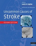 Cover: Uncommon Causes of Stroke - Cambridge University Press