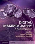 Cover: Digital Mammography - Cambridge University Press