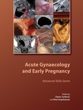 Cover: Acute Gynaecology and Early Pregnancy - Cambridge University Press