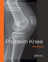Enlarge image Cover: The Problem Knee - CRC Press