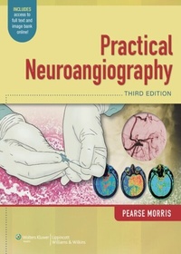 Abbildung von: Practical Neuroangiography - WOLTERS KLUWER HEALTH