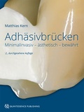 Cover: Adh&auml;sivbr&uuml;cken - Quintessenz Verlag