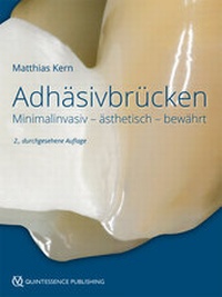 Abbildung von: Adhäsivbrücken - Quintessenz Verlag