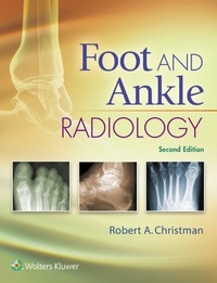 Abbildung von: Foot and Ankle Radiology - WOLTERS KLUWER HEALTH