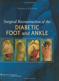 Abbildung von: Surgical Reconstruction of the Diabetic Foot and Ankle - WOLTERS KLUWER HEALTH