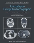 Cover: Ganzk&ouml;rper-Computer-Tomographie - Springer