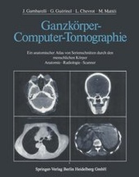 Enlarge image Cover: Ganzkörper-Computer-Tomographie - Springer