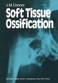 Abbildung von: Soft Tissue Ossification - Springer