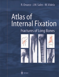 Enlarge image Cover: Atlas of Internal Fixation - Springer