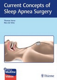 Enlarge image Cover: Current Concepts of Sleep Apnea Surgery - Thieme