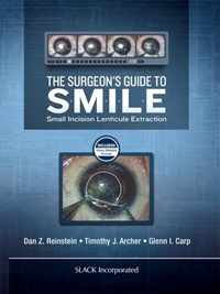 Abbildung von: Surgeon's Guide to SMILE - SLACK Incorporated