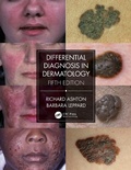 Cover: Differential Diagnosis in Dermatology - CRC Press