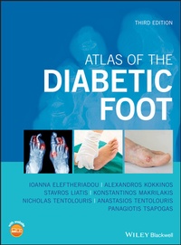 Abbildung von: Atlas of the Diabetic Foot - Wiley