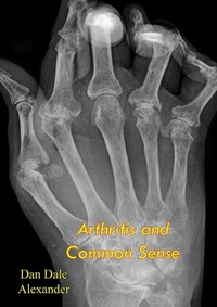 Enlarge image Cover: Arthritis and Common Sense - Muriwai Books