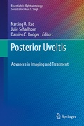 Cover: Posterior Uveitis - Springer