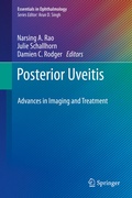 Cover: Posterior Uveitis - Springer