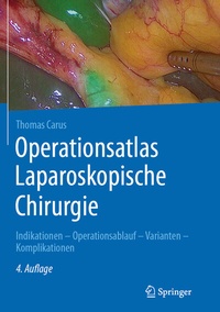 Abbildung von: Operationsatlas Laparoskopische Chirurgie - Springer