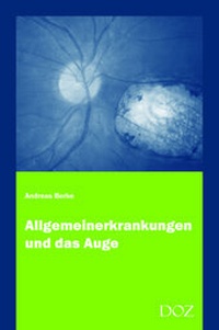 Abbildung von: Allgemeinerkrankungen und das Auge - DOZ-Verlag Optische Fachveröffentlichung