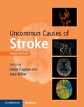 Cover: Uncommon Causes of Stroke - Cambridge University Press