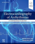 Cover: Electrocardiography of Arrhythmias: A Comprehensive Review - Elsevier