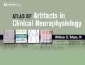Abbildung von: Atlas of Artifacts in Clinical Neurophysiology - Naval Institute Press