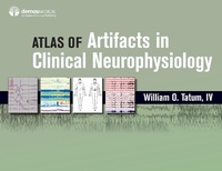 Abbildung von: Atlas of Artifacts in Clinical Neurophysiology - Naval Institute Press