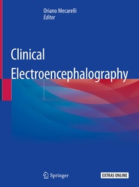 Bild: Clinical Electroencephalography - Springer