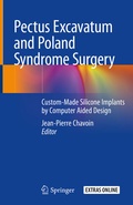 Bild: Pectus Excavatum and Poland Syndrome Surgery - Springer