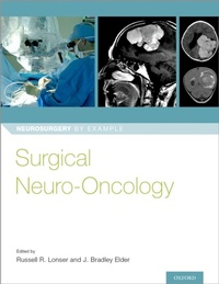 Abbildung von: Surgical Neuro-Oncology - OUP eBook
